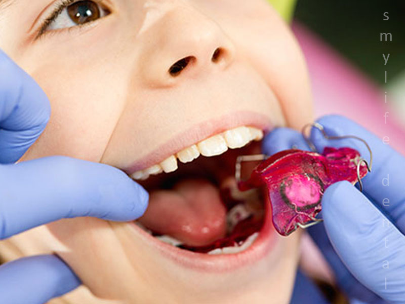 Best Orthodontist In Bangalore for evaluation of Children teeth